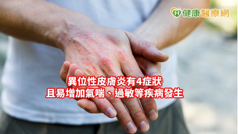 異位性皮膚炎也會增加氣喘、過敏性鼻炎、過敏性結膜炎、注意力較不集中等機率。