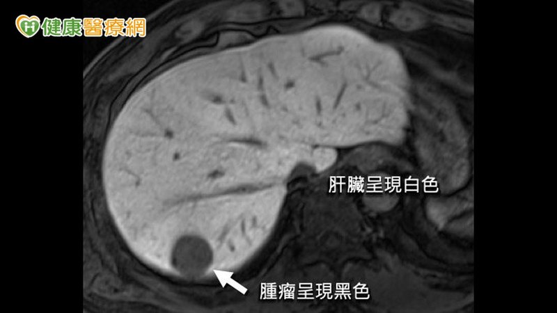 肝細胞特異性磁振造影顯影劑