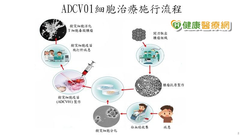 對付八大難治癌症　「免疫細胞療法」先進醫療武器