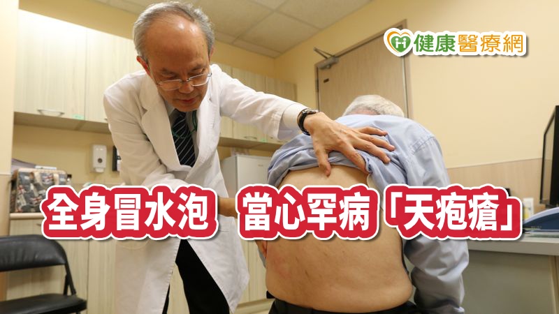 天疱瘡的症狀為全身性水疱、反覆性口腔潰瘍，當心是罕病「天疱瘡」，亞洲大學附屬醫院副院長、過敏免疫風溼科主任蔡肇基表示，天疱瘡是一種自體免疫疾病，發生率僅約20萬分之一，常見於中老年人。