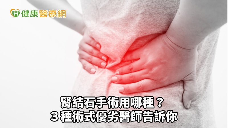 腎結石手術用哪種？　３種術式優劣醫師告訴你