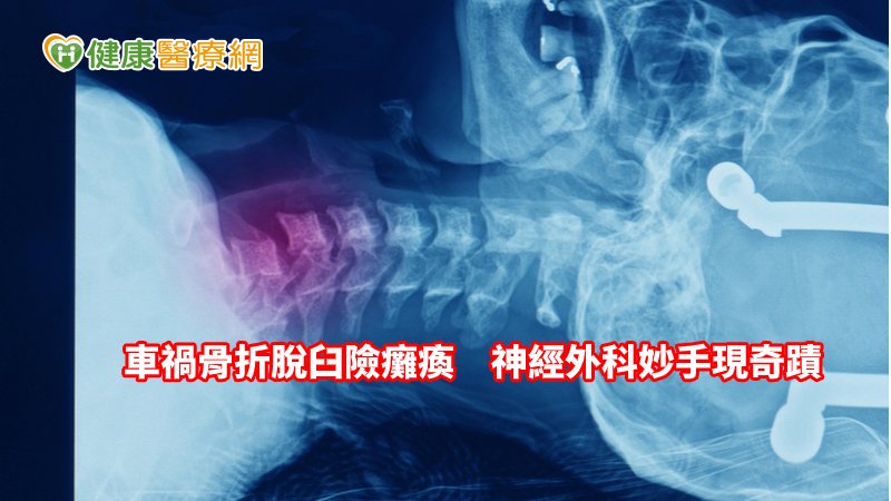 宋先生喜悅表示，很感恩洪醫師及時為他動手術治療，救回的不僅僅只是雙手，也是救回了他的命，讓他免於終身雙手癱瘓，很謝謝醫師的仁心仁術。