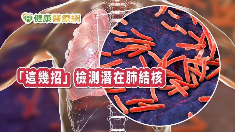 臺北市政府衛生局表示「預防勝於治療」，預防結核病可從「環境通風」、「早期發現」和「預防性治療」等三大面向著手。