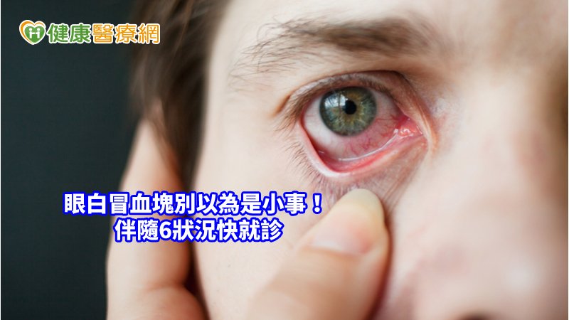 眼睛也會中風 眼球內出血伴隨6狀況快就診 健康醫療網 健康養生新聞資訊網路媒體