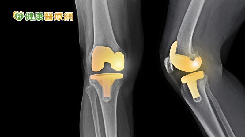 骨科陳建甫醫師診查患者的示意圖。(photo by 衛福部南投醫院)