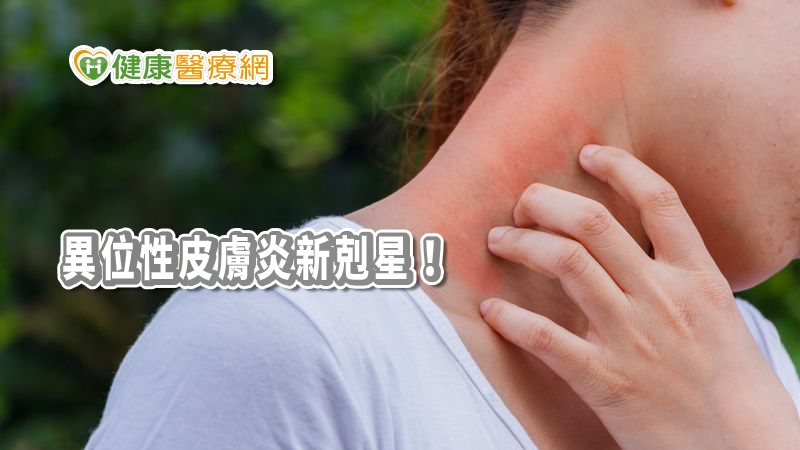 難以忍受的異位性皮膚炎症狀，又將出現新剋星！國內生技集團與丹麥皮膚醫學大藥廠合作研發新藥，抗免疫球蛋白E的獨家技術，具突破性進展。