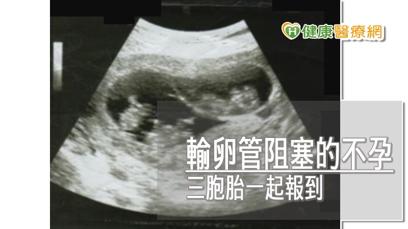 出動十二位醫護人員在產房順利接生了三位男嬰，創下該院產房最多醫護接生紀錄。