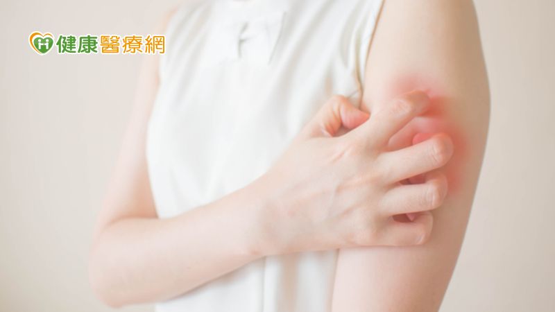 目前已有新的生物製劑可有效控制異位性皮膚炎病症，也可大幅降低傳統用藥的副作用，這對需要長期控制疾病的患者而言，無疑是一大佳音。
