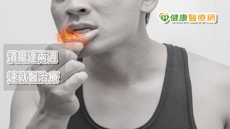 口腔癌佔台灣男性發生率及死亡率的第四位，衛生福利部南投醫院吳昭寬醫師表示，九成的口腔癌民眾有吃檳榔習慣，檳榔中的檳榔素(arecoline)和檳榔鹼(arecaidine)會誘發頭頸部癌症，對人體的細胞，尤其是上皮黏膜細胞，會加速細胞分裂，所謂癌化癌變的可能性。嚼檳榔及吸菸是造成口腔癌主因，即便癌症已經治癒，仍需戒除菸檳，長期保持良好生活習慣，並定期追蹤。