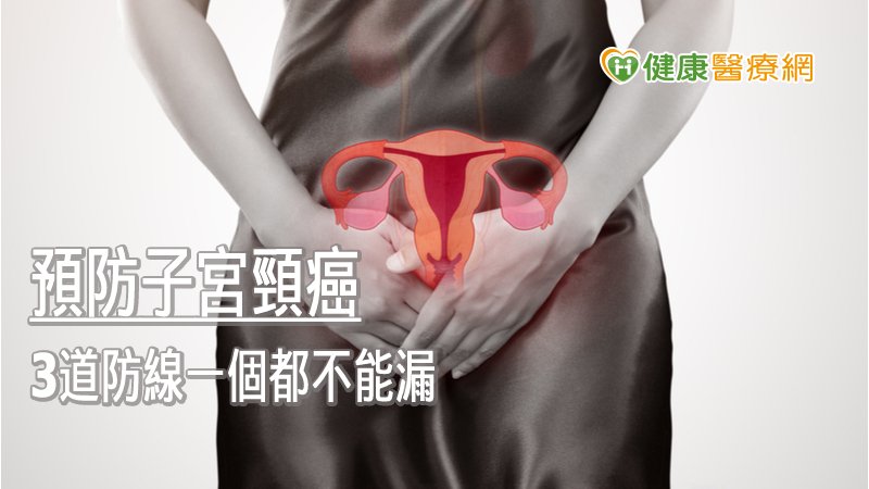 子宮頸癌是經由性行為感染人類乳突病毒(HPV)所致，雖然感染後多會自行痊癒，但仍有少部分人會持續感染，可能會發生子宮頸癌前病變，甚至子宮頸癌。