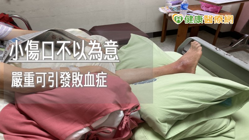 當皮膚或粘膜傷口遭到包括鏈球菌或者金黃色葡萄球菌等細菌感染時，就會引起蜂窩性組織炎，嚴重時恐危及生命。