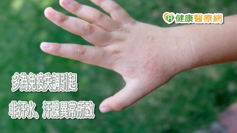 中醫師余雅雯指出，汗皰疹並不是汗水、汗腺引起的，是由於體內免疫失調，建議患者避免食用冰食、飲料、瓜果類、甜的飲料，不要久待待潮濕的環境，不建議游泳，以免增加濕氣，加重病情。
