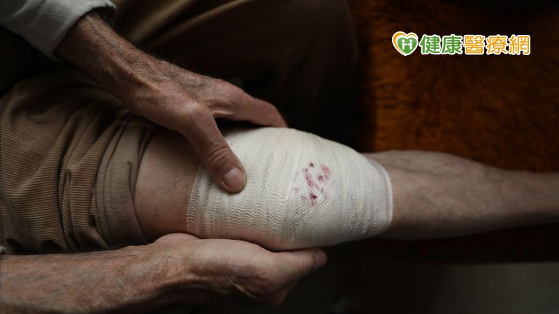 許多慢性傷口的病人，常併有年紀大、三高控制不良、各式感染、腎功能不良等多領域和多專科的問題。