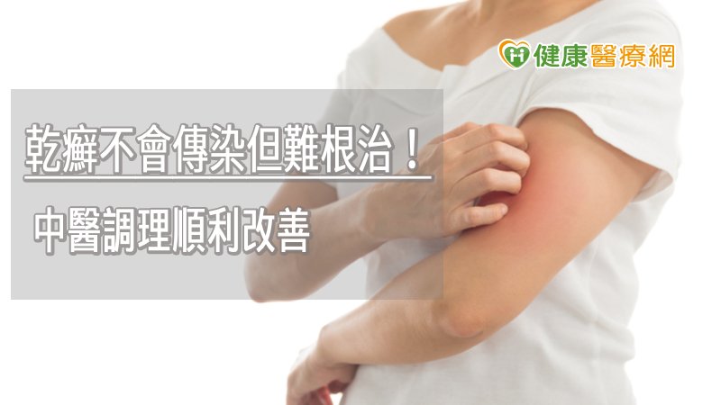 乾癬不具傳染力，但因病程長，加上症狀反覆，在臨床上較難以根治，因此患者更應積極接受治療。