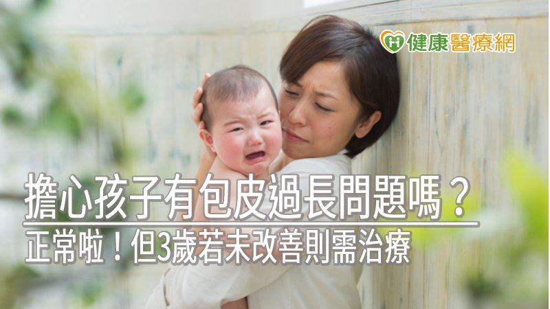 發現新生兒包莖好擔心？　正常啦！但3歲若未改善則需治療