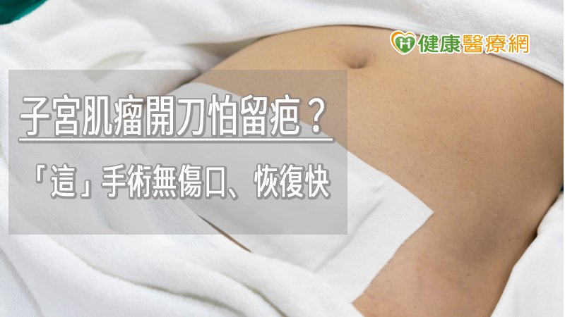 自然孔腹腔鏡手術具備腹部無傷口、疼痛少、恢復快等三大優點，兼顧了美觀且能有效縮短住院天數。