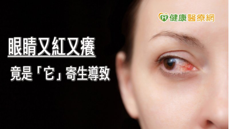 50歲婦眼睛又紅又癢　竟是蠕形蟎蟲寄生導致