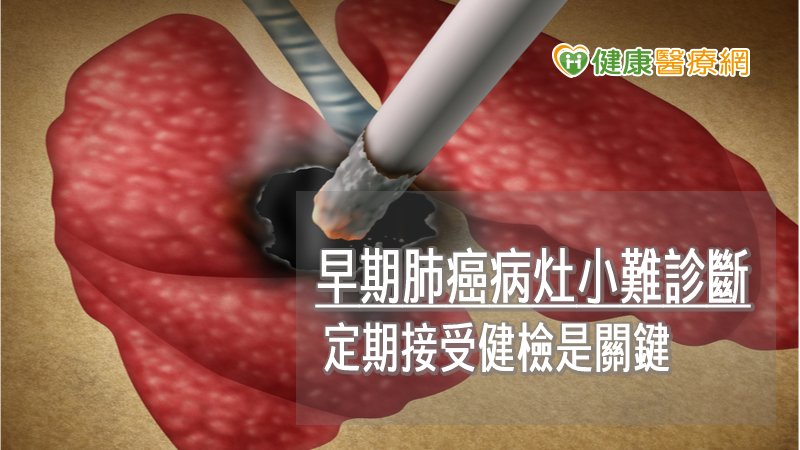 肺癌最常見的危險因子仍為抽菸，但即便沒有抽菸，若有家族史、暴露於二手菸、室外空汙、室內空汙、化學藥劑暴露等，也應特別注意；因早期肺癌不易發覺，建議民眾應定期接受健康檢查，才能早期發現，早期治療。