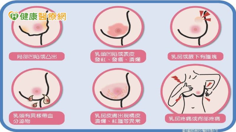 柏哲氏症(Paget’s Disease)主要的表徵為乳房周圍的皮膚，尤其是乳頭乳暈處出現搔癢、潰爛、脫屑等症狀，容易誤以為是濕疹等皮膚疾病。