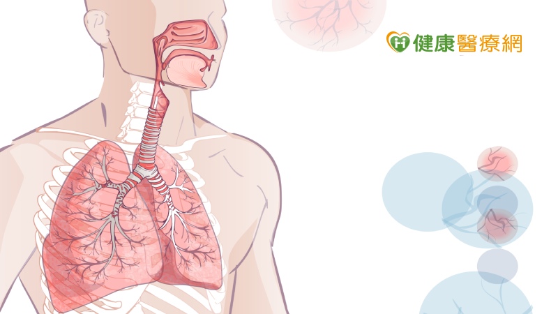 新冠肺炎輕症變重症　胸腔科醫師：呼吸道微環境很關鍵