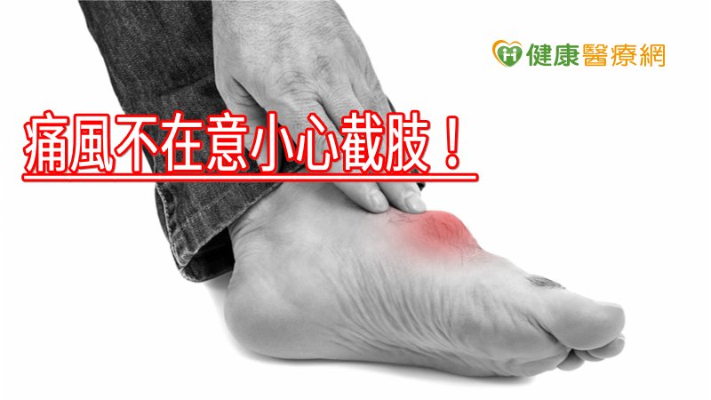 若痛風石已經影響到日常生活，且透過藥物溶解成效有限，就可以考慮開刀。