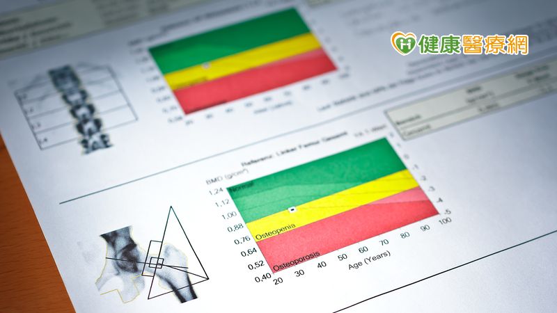 骨密度測量多部位　骨密之父錢本文：骨鬆診斷越準確！