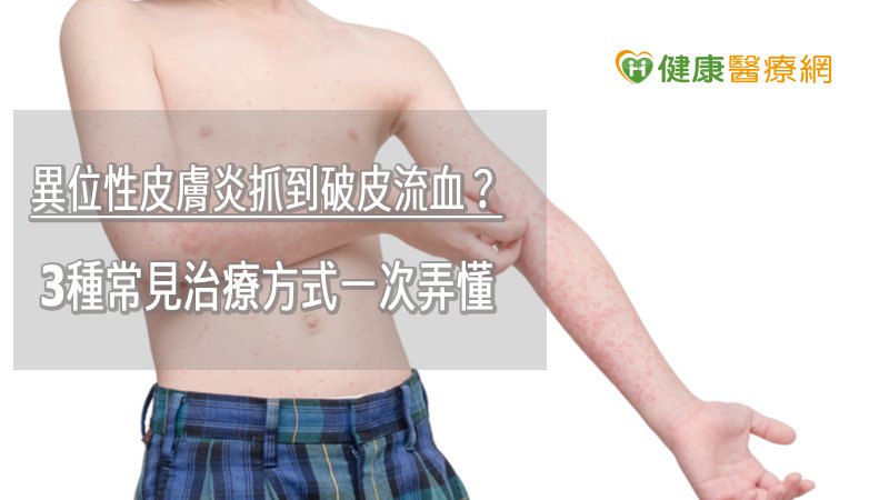 最新的治療不見得適合每一位異位性皮膚炎病人，傳統治療也經得起時間的考驗，最重要的是，病人時時刻刻保持開放的態度主動與醫師討論，充分配合醫囑與建議，才是異位性皮膚炎治療順利與否的關鍵。