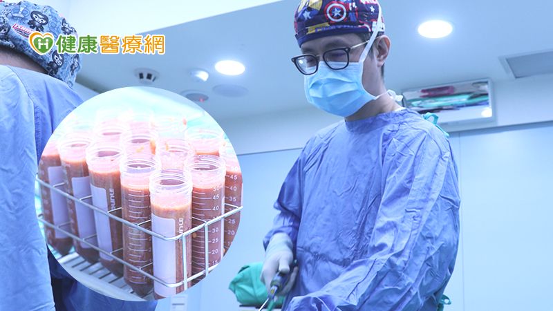 邱浚彥醫師也提醒，自體脂肪補臉應避免一次在同一部位填補大量脂肪，可能使填補部位壓力過大，造成細胞壞死，因由專業醫師考量是否分次填補較適宜。