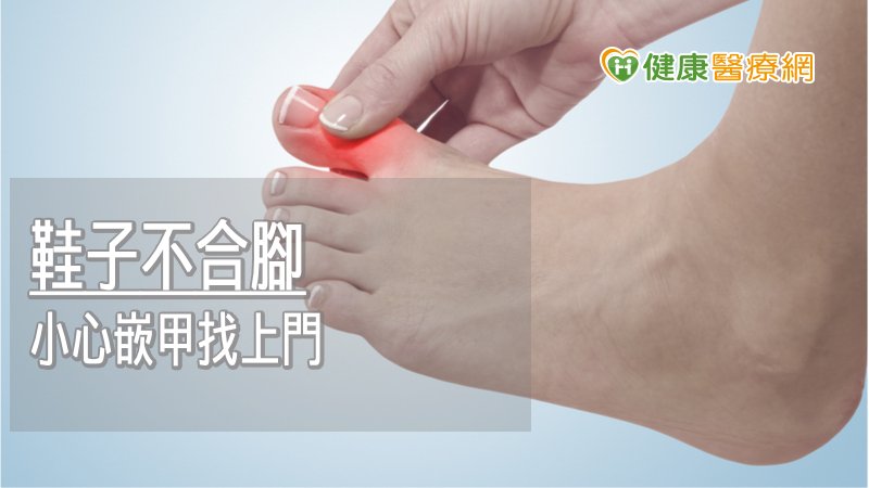 治療嵌甲上，仍以找到病因為主，可望幫助病患減少復發機率。