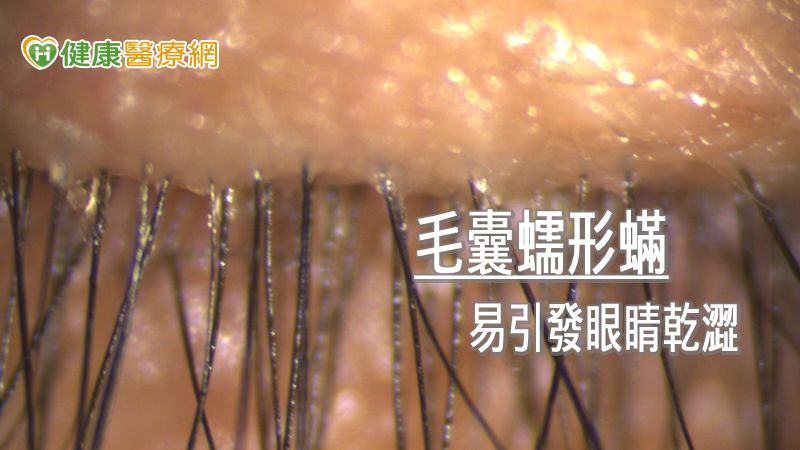 脈衝光治療並且可以降低乾眼症患者的發炎反應，因此改善了傳統乾眼治療的藥物依賴度並減少副作用，甚至對無法根治的毛囊蠕形蟎也可能有抑制效果，所以可針對瞼板腺功能障礙所引發蒸發型乾眼症進行治療。