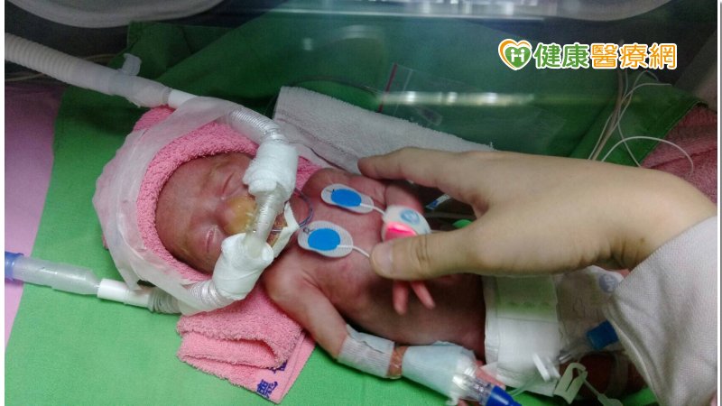 早產兒出生體重僅一杯手搖飲　早產兒基金會愛傳東台灣