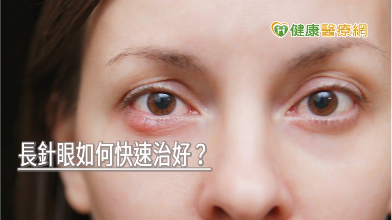 長針眼時不宜戴隱形眼鏡，且不要隨便用手去觸摸眼睛，也要暫停化粧、塗眼影、畫眼線及塗睫毛膏等，以免感染更嚴重。