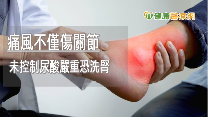 痛風主要是因尿酸鈉鹽沉積在關節腔內，導致關節腫脹變形，多好發於下肢關節，但包括足背、踝、膝、腕、肘，甚至手指間都有可能誘發。