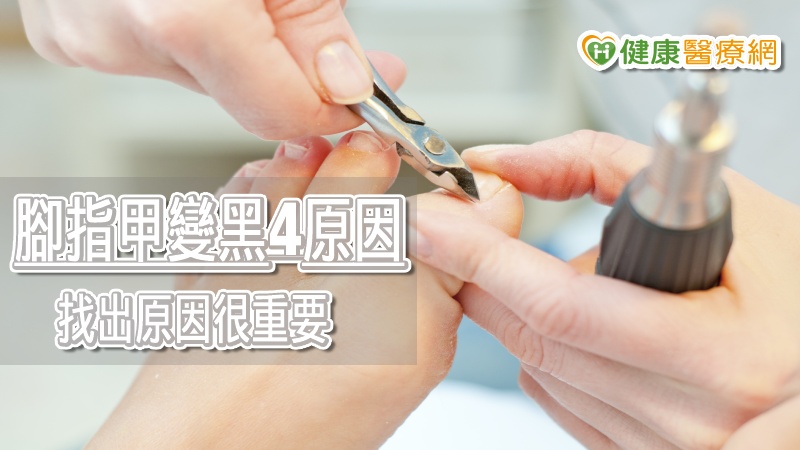 足部外科醫生Jacqueline Sutera專家說，找出指甲變黑原因很重要，指甲受傷有急性與慢性損傷的問題，如果發現任何指甲的變色跡象，建議前往足踝科或皮膚科醫生檢查和治療。