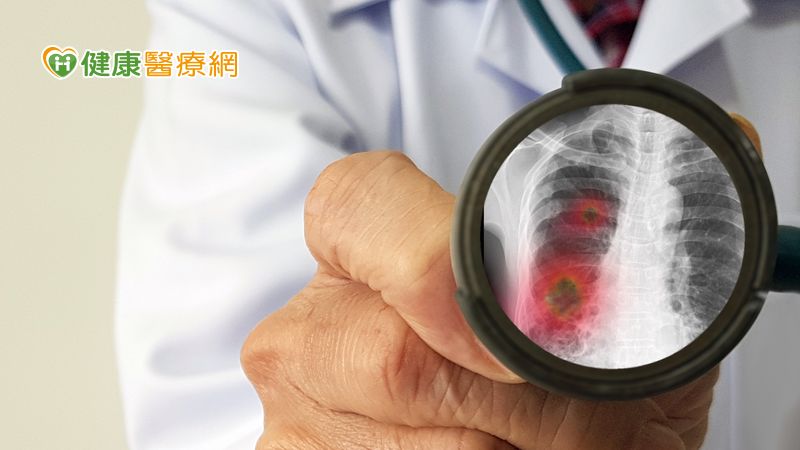 金黃色葡萄球菌所引發的肺炎症狀與一般肺炎相似，都是以咳嗽、發燒為主，患者的肺部、呼吸道會有很多痰，嚴重時，肺部甚至會出血、引發呼吸窘迫。