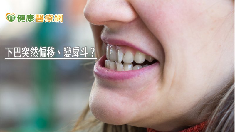 除了家族性遺傳的戽斗、小下巴外，青少年在成長發育期間，也可能因不良姿勢與習慣，導致臉部發育異常，這些問題除了影響外觀，也會同時造成咬合咀嚼與呼吸功能（睡覺打呼甚至造成睡眠呼吸中止症）等問題，進一步使得營養攝取不良、人際關係不佳，以及工作效率低落，甚至心臟血管系統受到損傷。