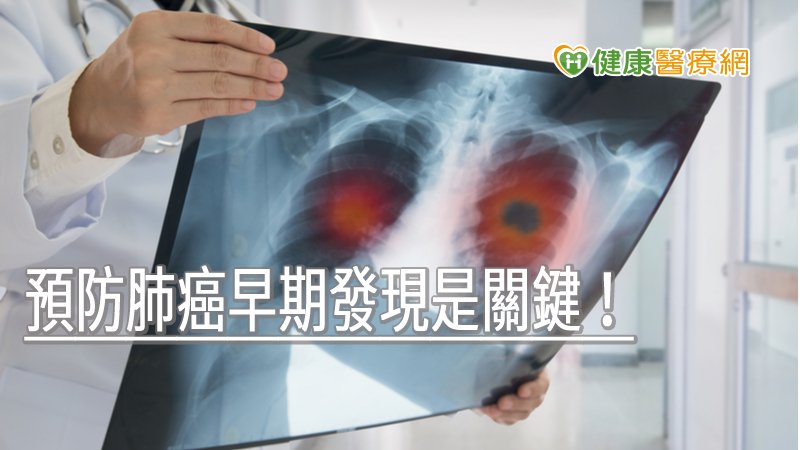預防肺癌早期發現是關鍵！　成大醫院員工607名篩檢21人確診