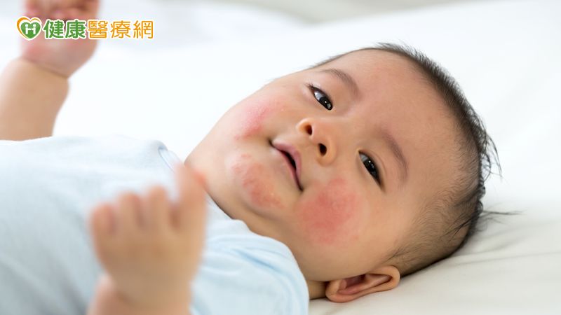 許多家長因為對嬰幼兒過敏的敏感度不足，而忽略了寶寶身上的過敏症狀，以為短暫的症狀退了就沒事，卻不曉得這是寶寶身體傳遞出的警訊，朱世明醫師提醒家長，平時要仔細觀察寶寶是否有過敏情況，並積極觀察寶寶過敏原因，進一步避免接觸過敏原