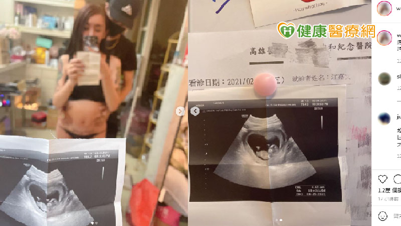 跨性別網紅罔腰在社群媒體上曬出超音波照宣稱懷孕。