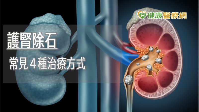 結石的長期阻塞若沒有治療而放任腎臟水腫，時間一久腎臟就會慢慢萎縮甚至完全沒有功能，後續可能造成敗血症、腎衰竭、洗腎、癌症，甚至死亡的可能性。