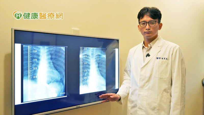 嘉基內視鏡室主任周莒光醫師說明，食道弛緩不能症會造成胸燒胸悶，容易被誤認為一般的食道逆流，嚴重可能造成吸入性肺炎，須留意。