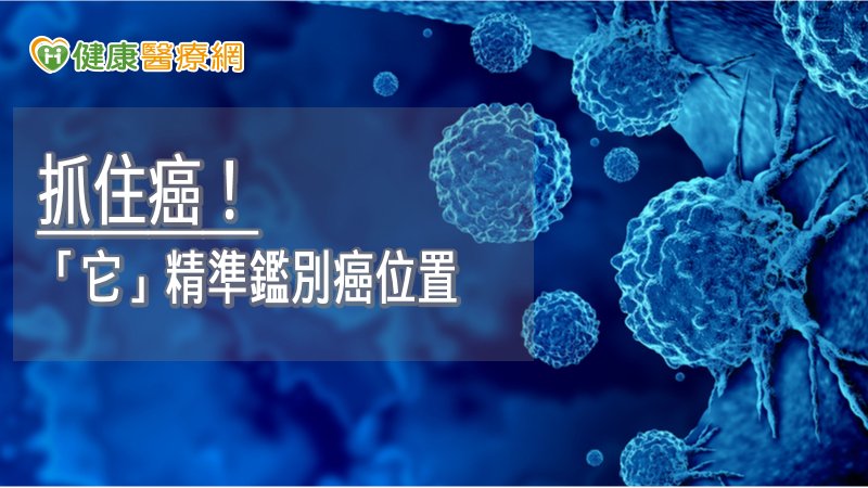 抓住癌！　「氟18去氧葡萄糖」精準鑑別癌位置