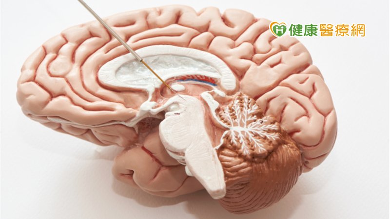 深層腦部電刺激　北榮成功改善妥瑞氏患者症狀