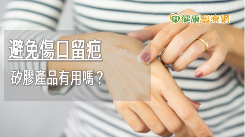 避免傷口留疤　矽膠產品有用嗎？