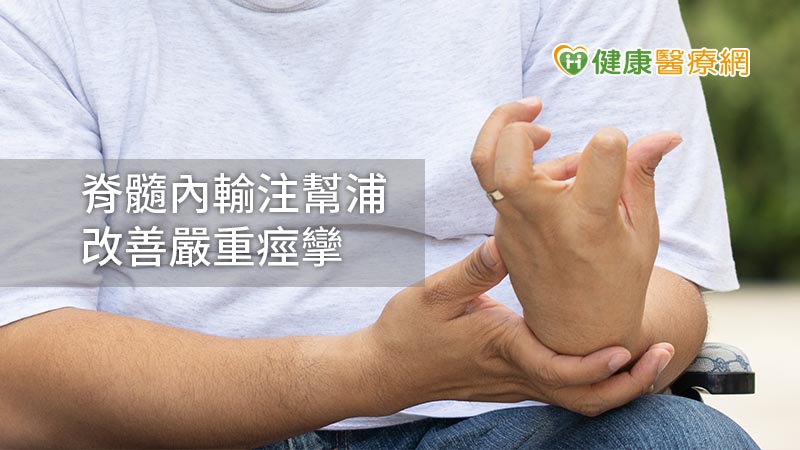 嚴重性痙攣致行動不便　「脊髓內輸注幫浦療法」助改善