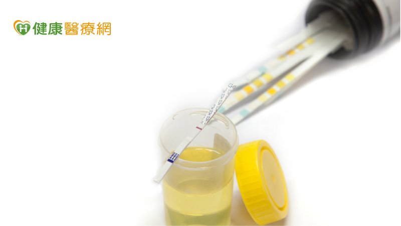 各廠牌的排卵試劑判讀方式及最佳使用方式略有出入，民眾使用前一定要詳讀說明，才能發揮最佳效果。