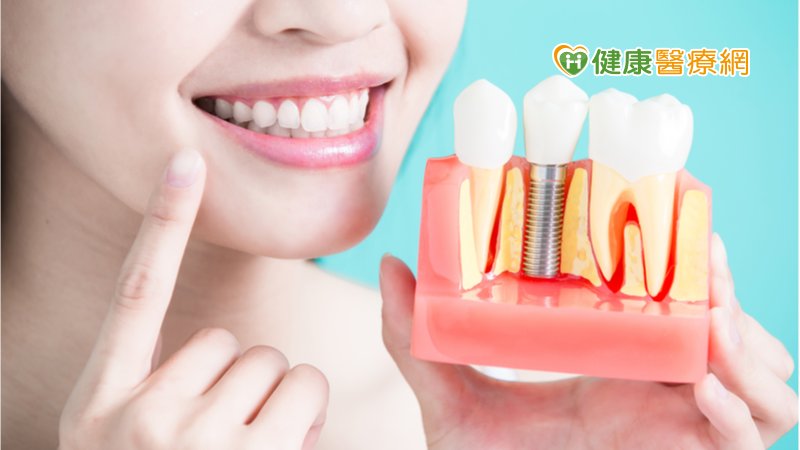 植牙前應與醫討論評估　確保植牙成功率