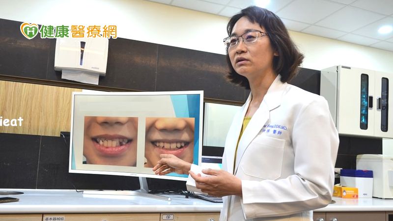 擅長兒童矯正醫學的黃汝萍牙醫師表示，許多家長認為等孩童生長發育穩定後再進行牙齒矯正也不晚，確實！但這往往可能會參雜較多的複雜因子，影響後續矯正的難易度、攏長的時間及不必要花費。