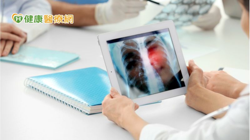 如何遠離肺癌找上門？　國健署教必學「顧肺４招」