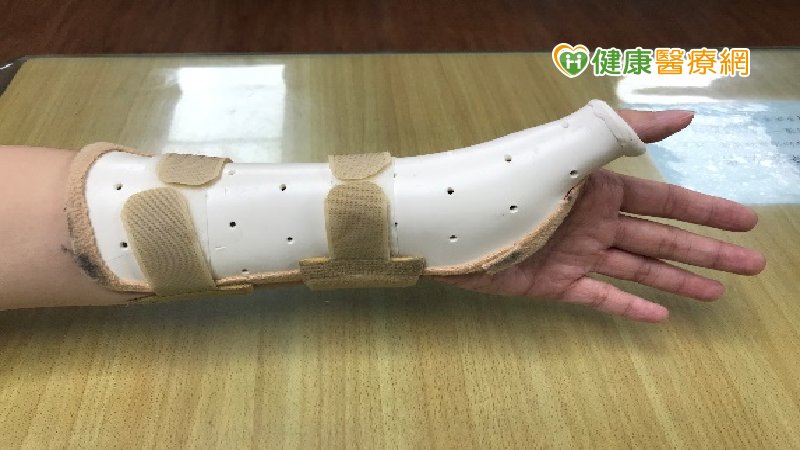 穿戴副木的期間，仍要配合治療師針對個別狀況教導的復健計畫，避免長時間固定導致的關節僵硬、肌肉萎縮等狀況。